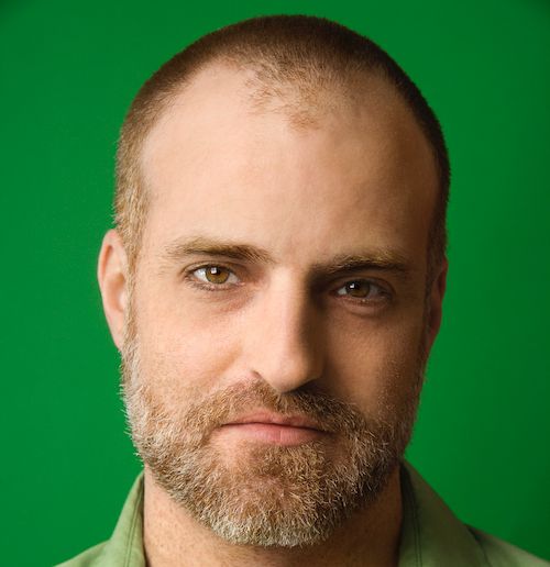 4 Reasons Why People Have An Uneven Hairline
