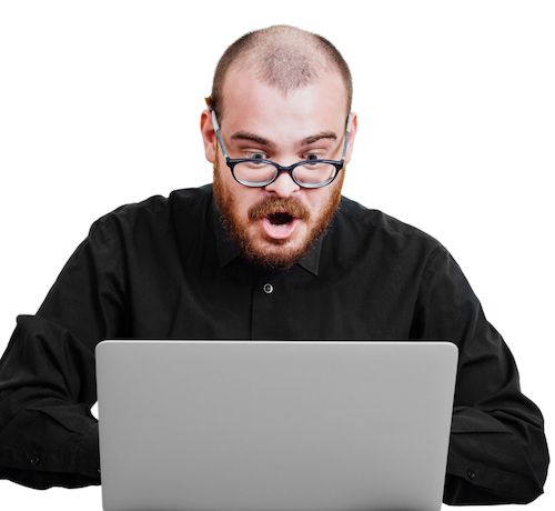 Everything You Need To Know Before Having A Hair Transplant