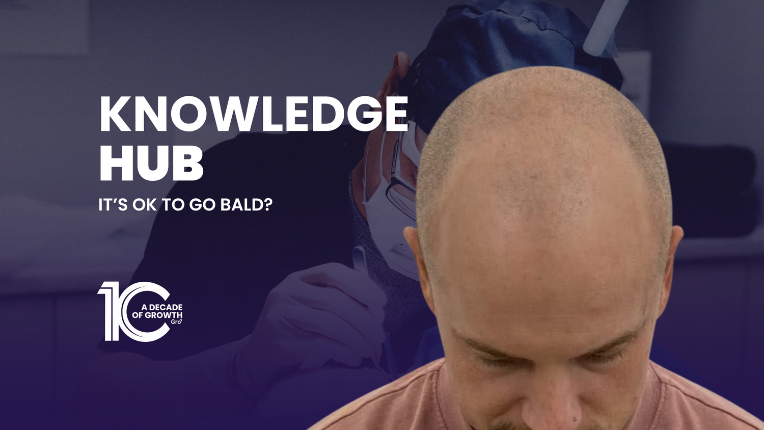 It’s OK to Go Bald?