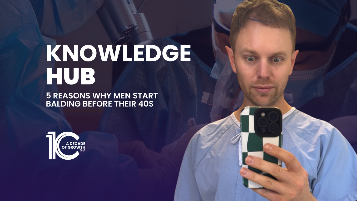 5 Reasons Why Men Start Balding Before Their 40s