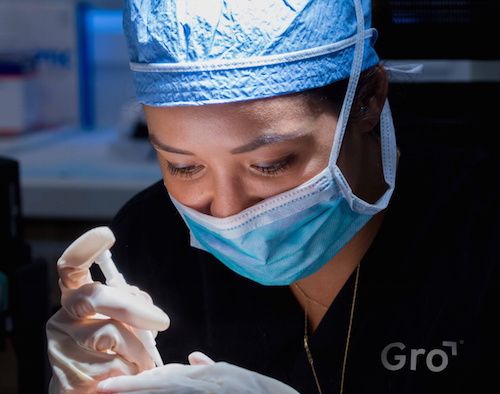 Working From Home? Best Time To Recover From A Hair Transplant