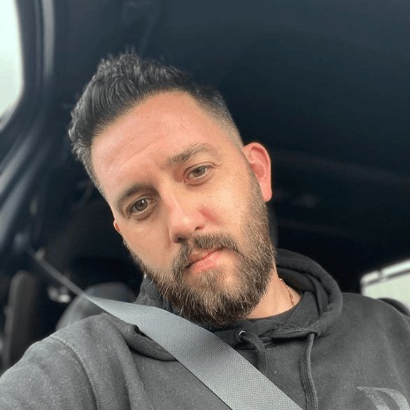 The Full Results: 12 Months After Marc’s reGro™ Hair Transplant