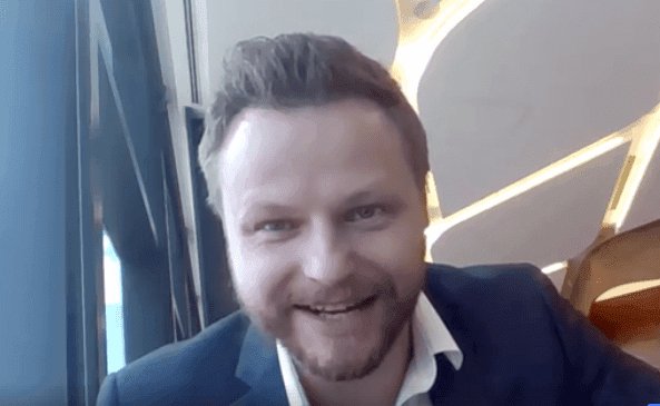My Gro Hair Transplant Journey: 6 Month Progress Report