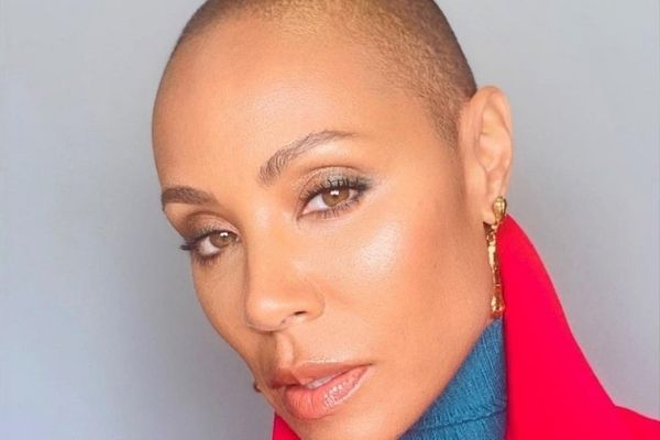Alopecia Is No Joke: Jada Pinkett Smith and What Happened at the Oscars