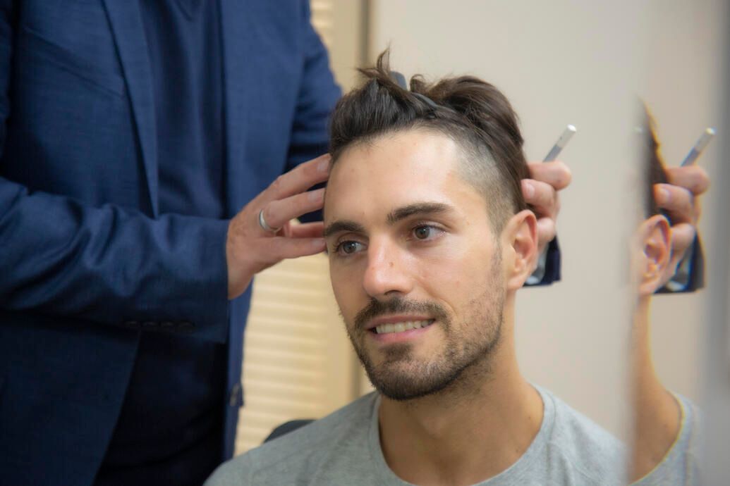 Scalp Micropigmentation vs the Hair System