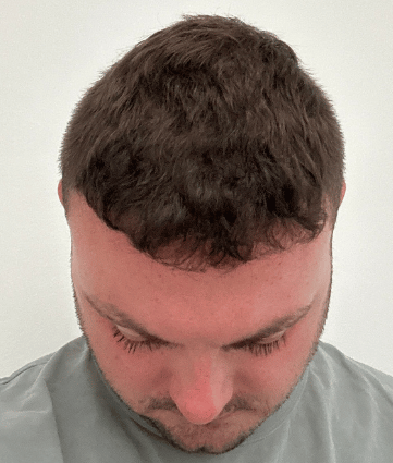 After image for James