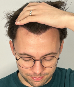 After image for Adam