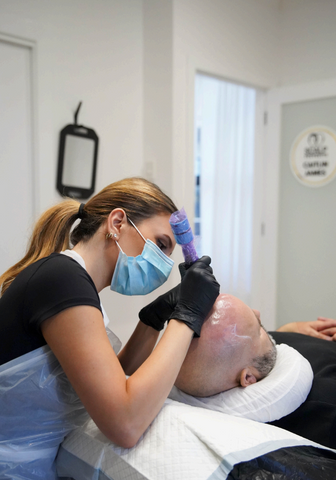Scalp Micropigmentation