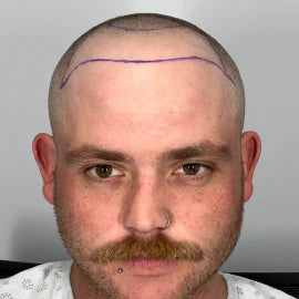 Before image for Jackson