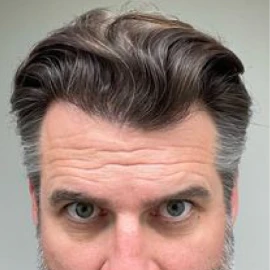 After image for Phillip