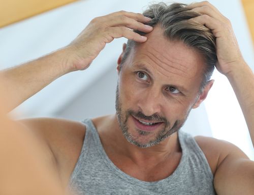 Hair Loss: How to Differentiate Baldness & Alopecia Areata