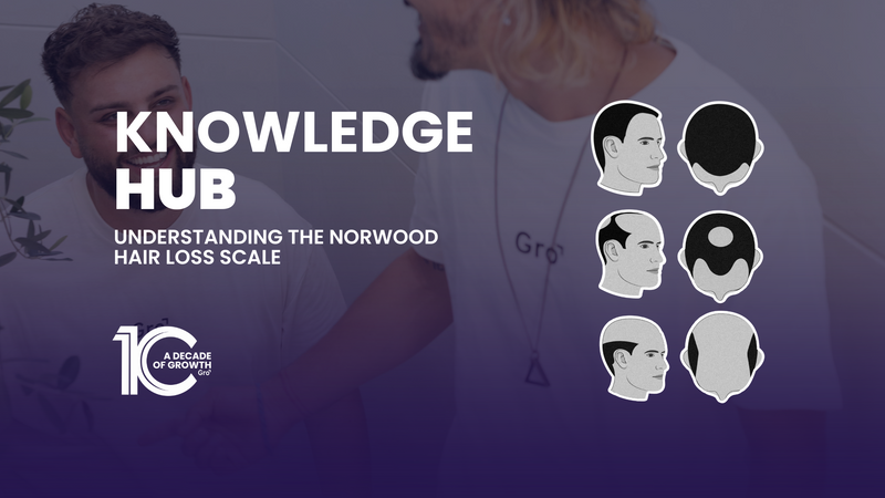 Hair Loss 101: Understanding the Norwood Hair Loss Scale