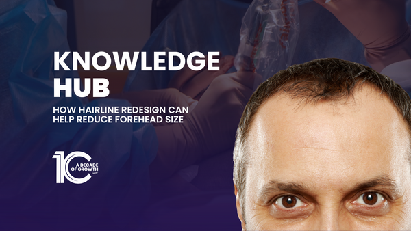 How Hairline Redesign Can Help Reduce Forehead Size
