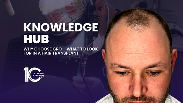 Why choose Gro – What To Look for in a Hair Transplant