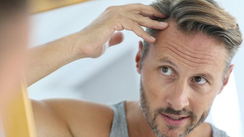 5 Reasons Why Men Start Balding Before Their 40th