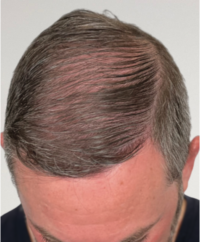 After image for 