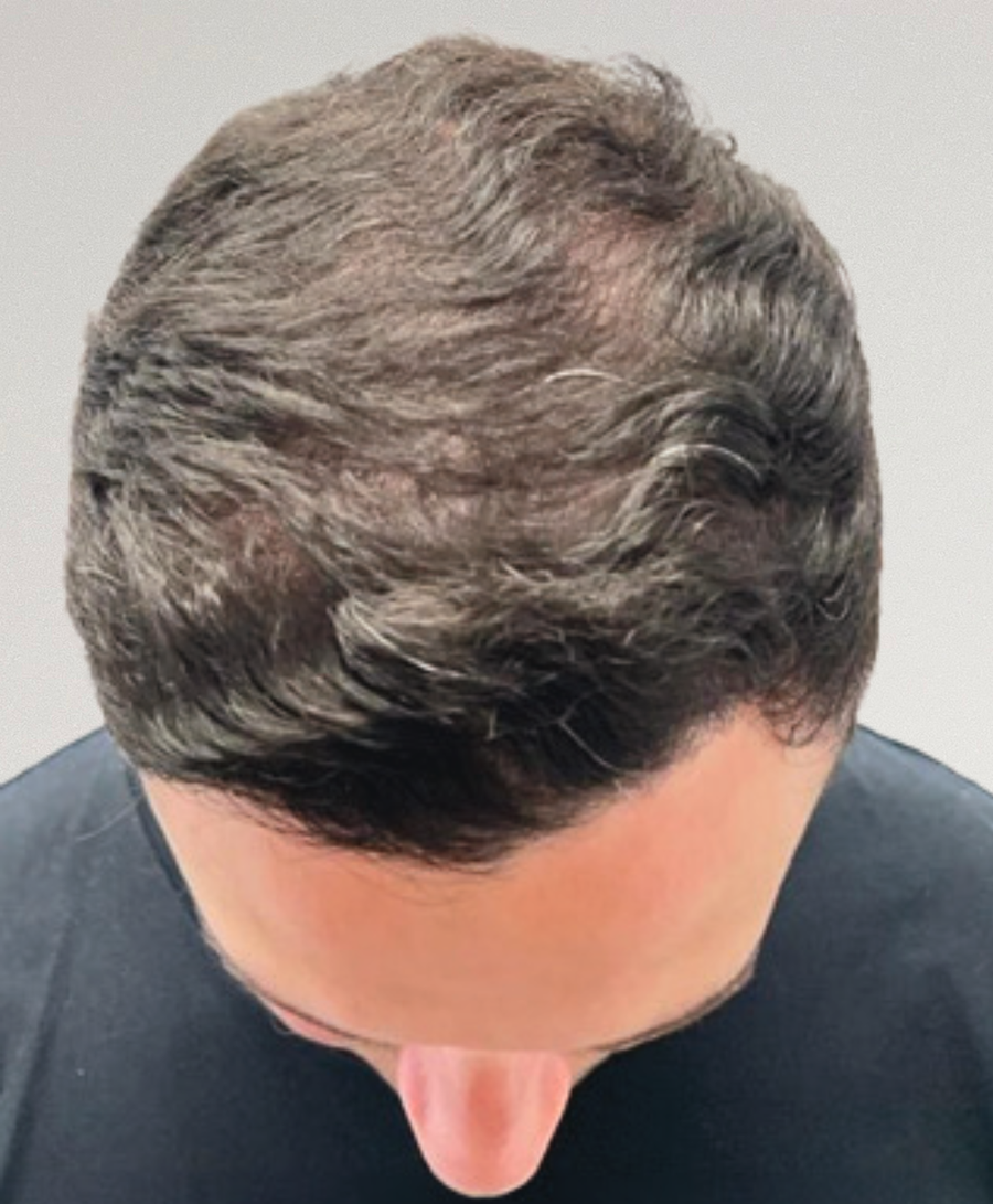 The same patient after treatment