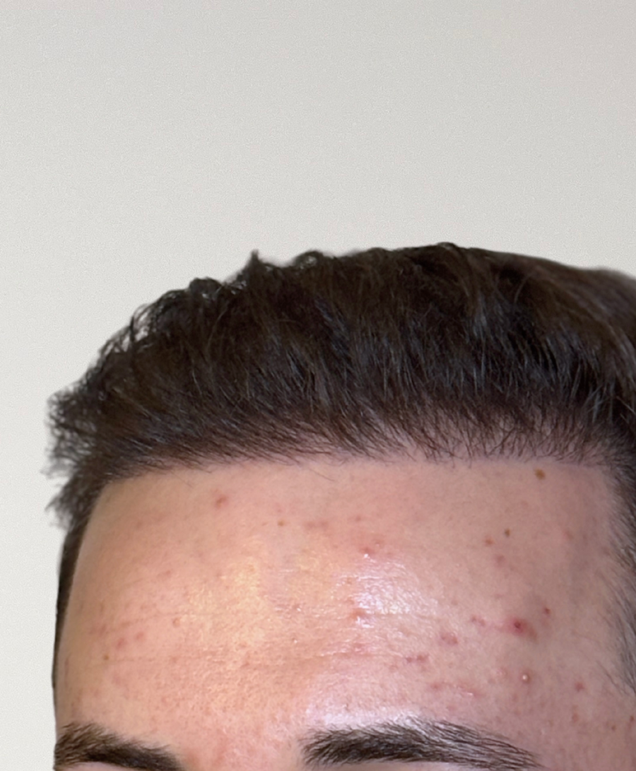 The same patient 6 Months