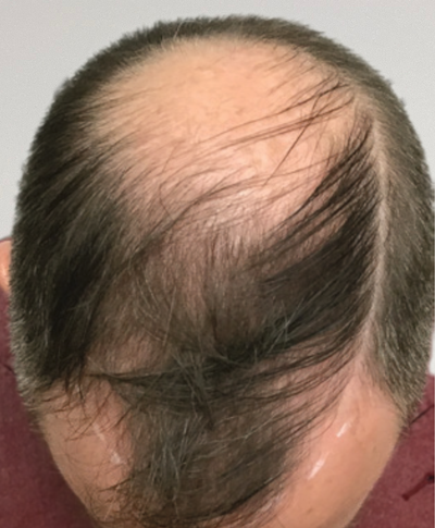 Before image for 