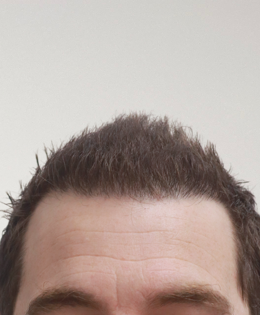 The same patient 6 months