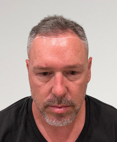 Before image for Joel Gurciullo