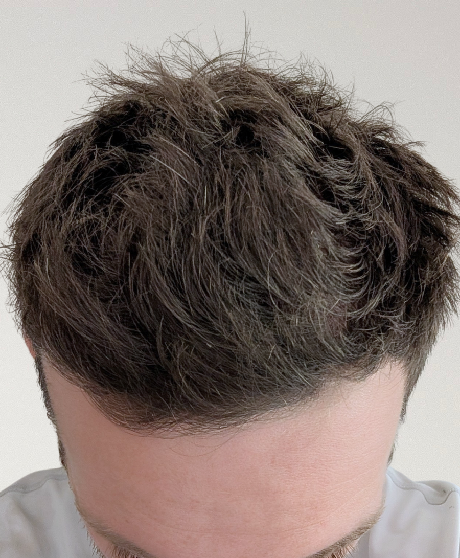 The same patient 6 Months