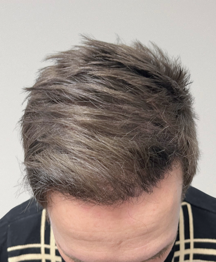 The same patient 6 months