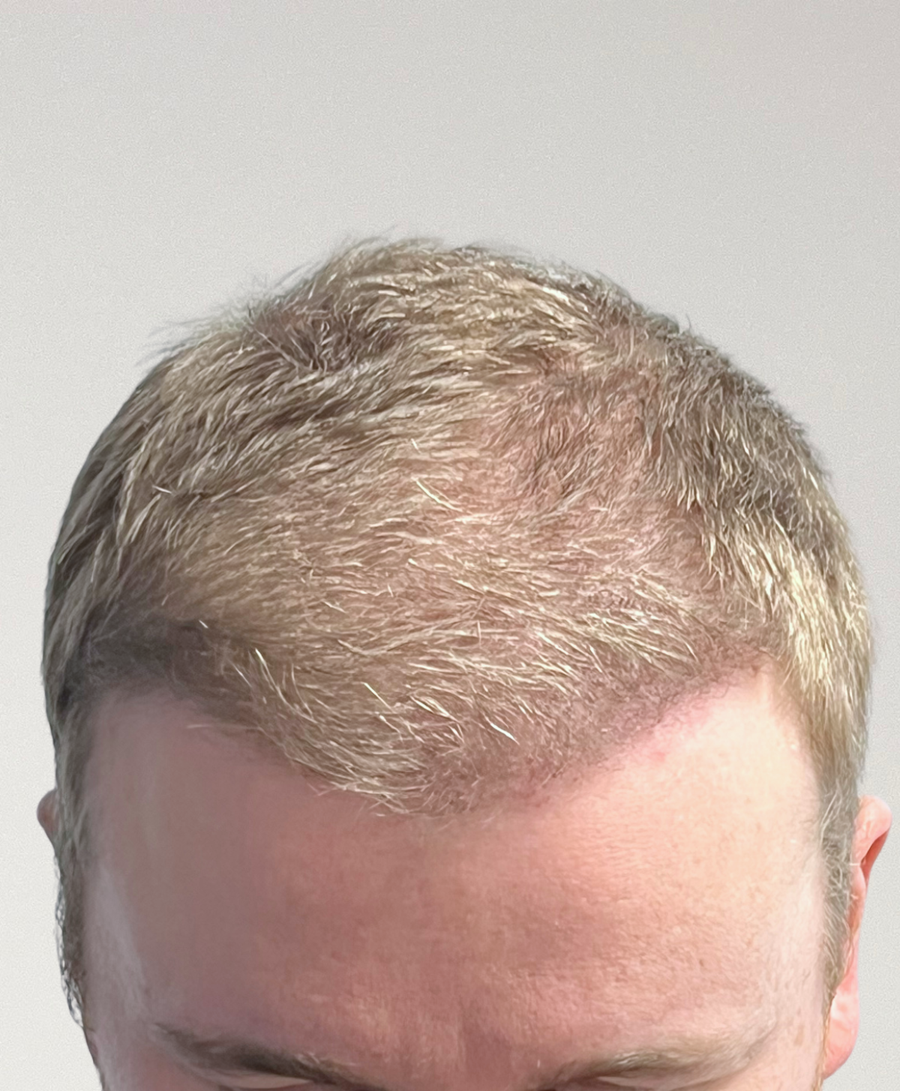 The same patient 6 months