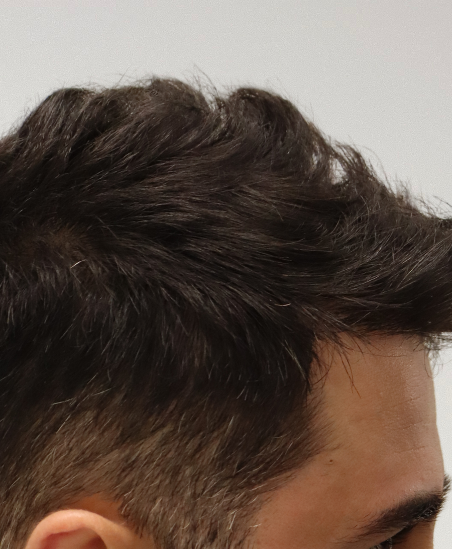 The same patient 1 year