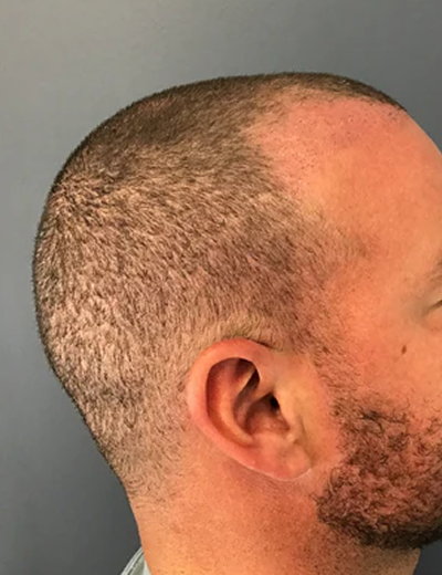 Before treatment