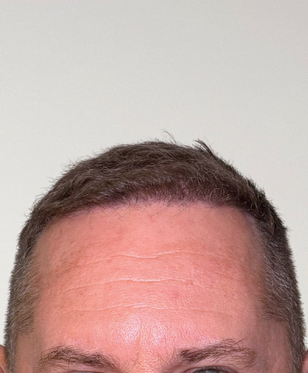 After treatment
