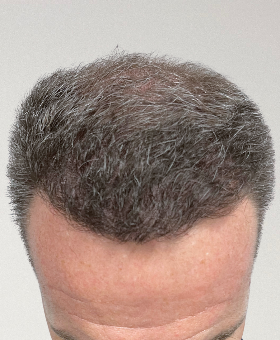 The same patient 9 Months