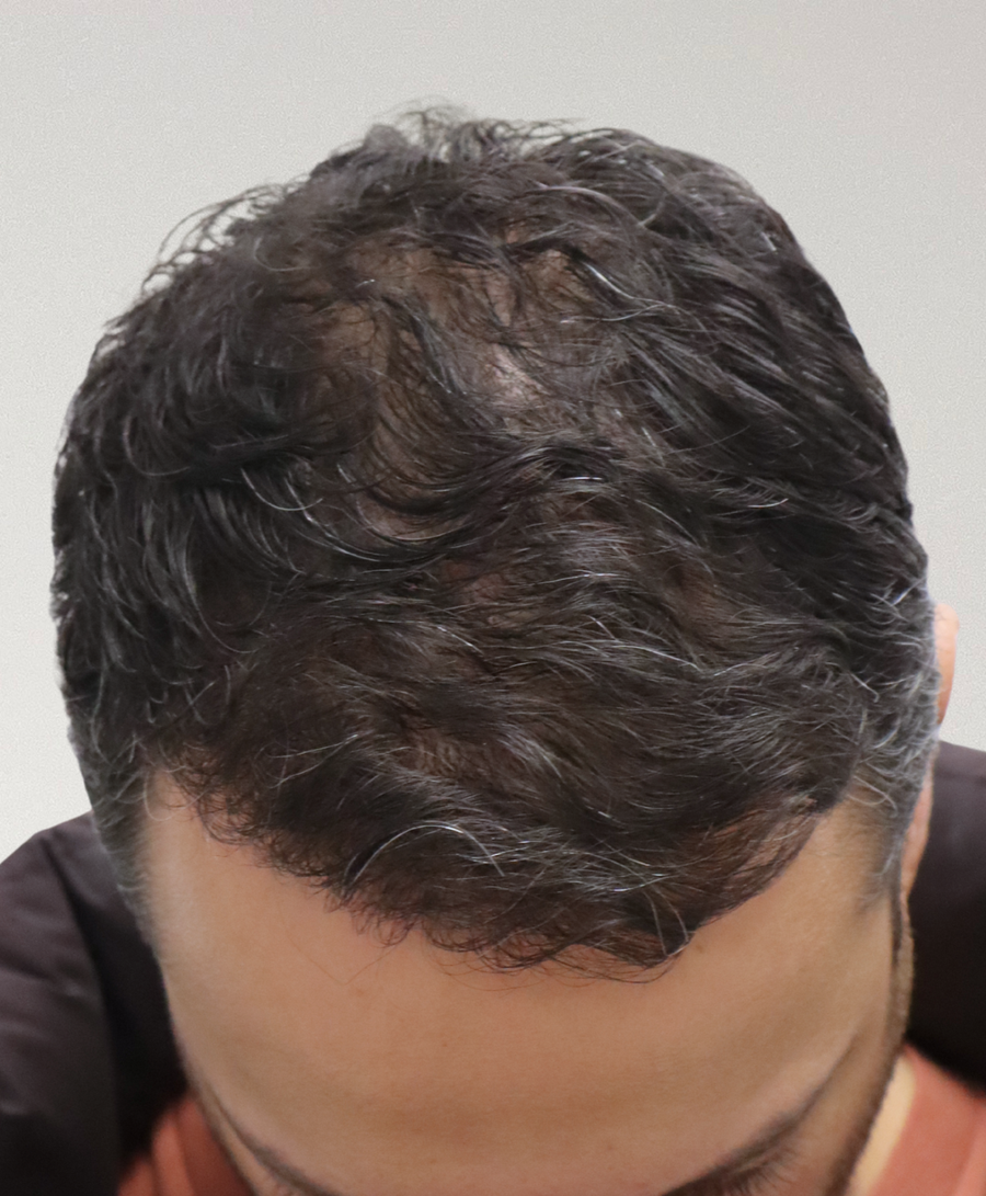 The same patient 6 months
