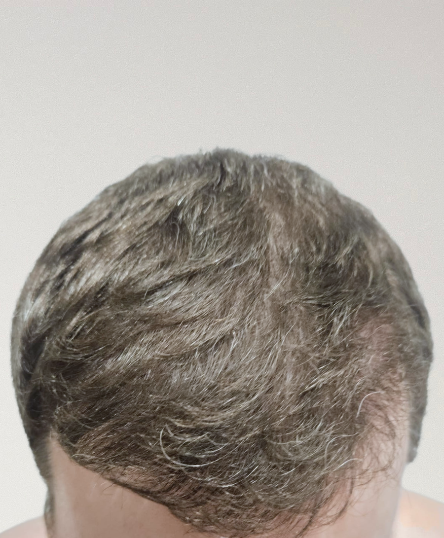 The same patient 6 months