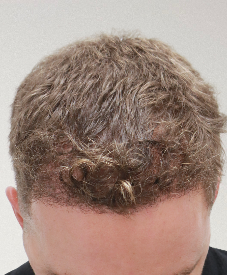 The same patient 6 months