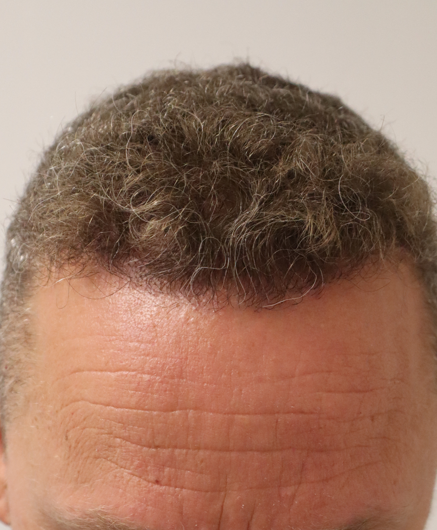 The same patient 1 Year