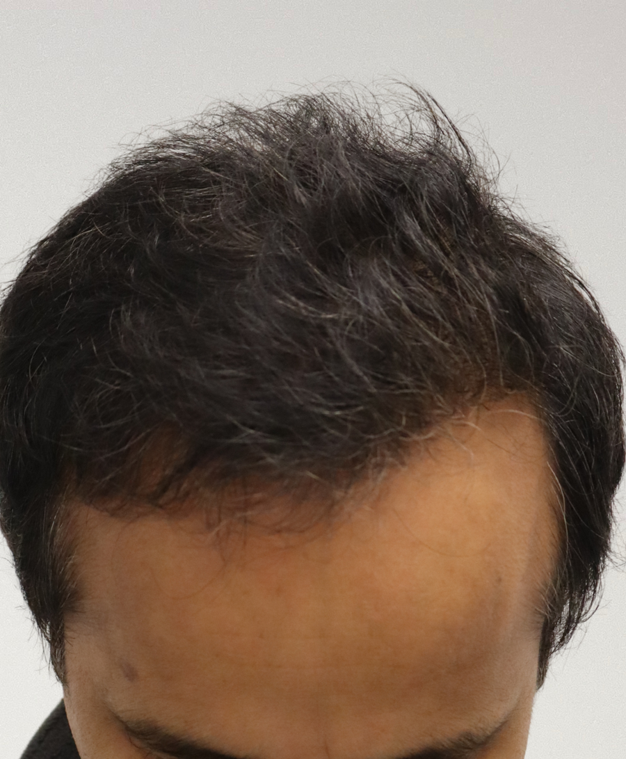 The same patient 6 months