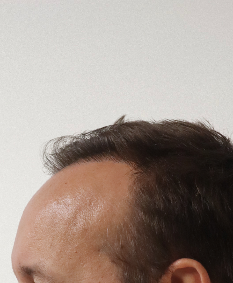The same patient 6 months