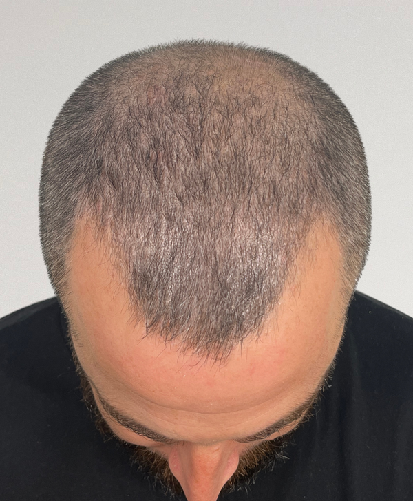 Before treatment