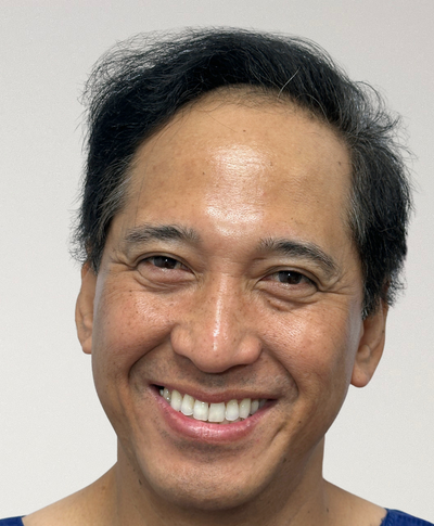 Before image for Chris Navales