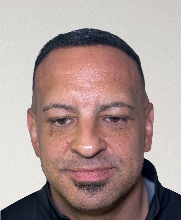 After treatment