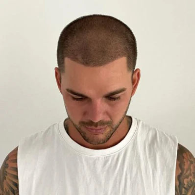 A non-surgical scalp treatment in progress at Gro Clinics